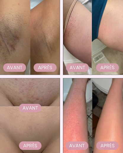 Mewira - Kit de rasage ultra doux sans iritation