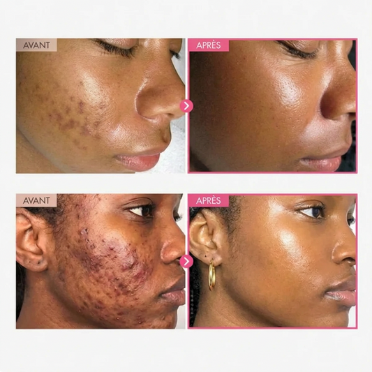 Crème anti-taches — teint éclatant