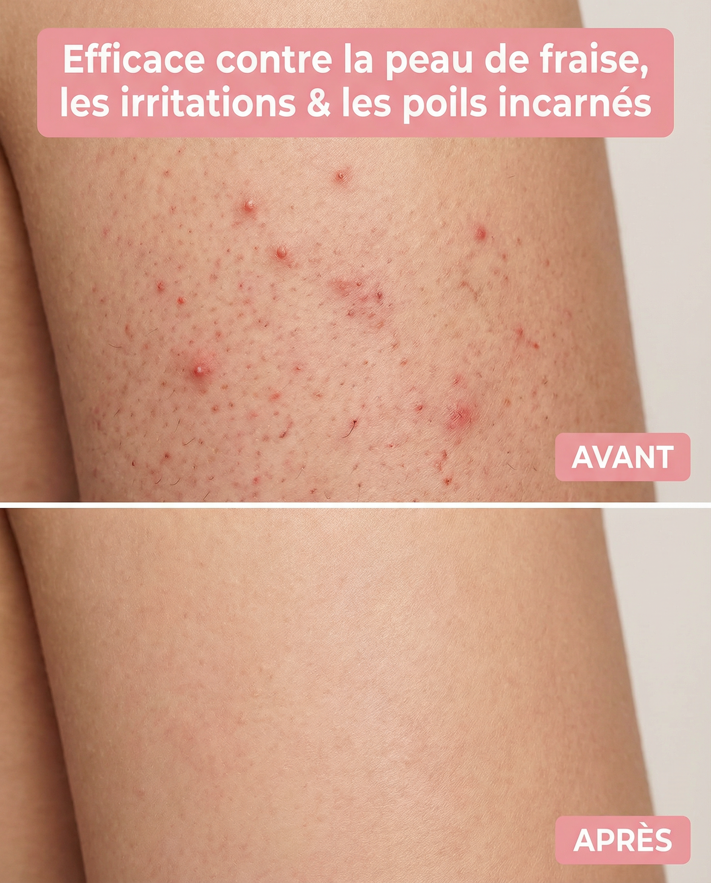 Mewira - Kit de rasage ultra doux sans iritation