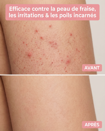 Mewira - Kit de rasage ultra doux sans iritation